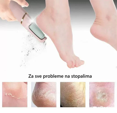 PediCare – Savršeno glatka stopala - Originalan Model