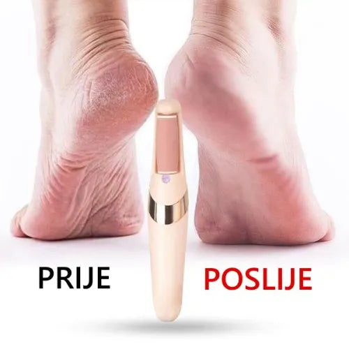 PediCare – Savršeno glatka stopala - Originalan Model